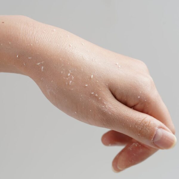 Ye:pre, Herbal PHA Peeling Gel, Cleanser, Cleanser, Dryness